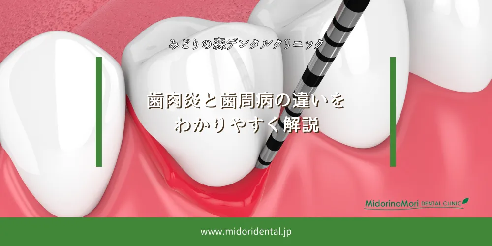 歯肉炎と歯周病の違いをわかりやすく解説
